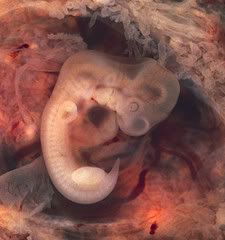 Bloody Fetus